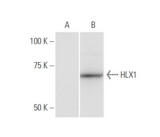 HLX1 Antibody (1B9) - Western Blotting - Image 347557 