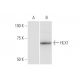 HLX1 Antibody (1B9) - Western Blotting - Image 347557 