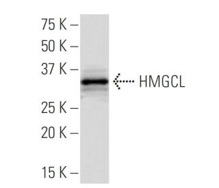 HMGCL Antibody (63Z) - Western Blotting - Image 33922 