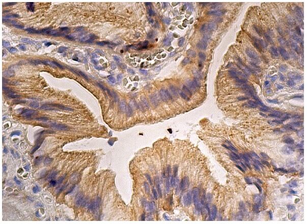 絵画 flk041195 HMGCR Antibody (C-1) | SCBT - Santa Cruz Biotechnology