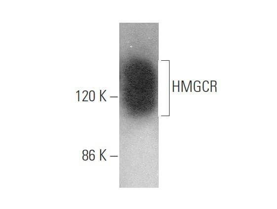 絵画 flk041195 HMGCR Antibody (C-1) | SCBT - Santa Cruz Biotechnology