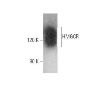 western blotting image from recommended HMGCR (C-1) monoclonal antibody replacement. Image 349956