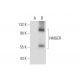 HMGCR (C-1): sc-271595. Western blot analysis of HMGCR expression in...