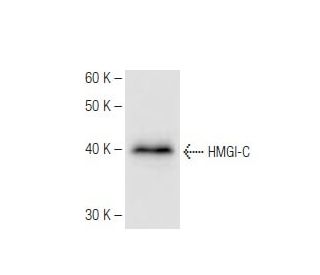 HMGI-C Antibody (2421C6a) - Western Blotting - Image 67285 