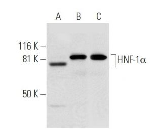 HNF-1α Antibody (F-7) - Western Blotting - Image 299198