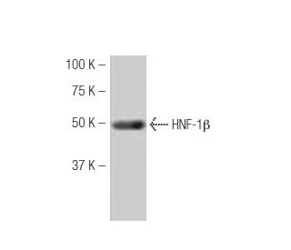 HNF-1&beta; Antibody (94.8) - Western Blotting - Image 53904The Double Nickase Plasmid features a U6 promoter for sgRNA expression, a 20 nt targeting sequence, and a gRNA scaffold to guide Cas9n. It includes a CBh promoter for Cas9n (D10A) and puromycin resistance, GFP for transfection verification, and nuclear localization signals (NLS). The 2A peptide allows co-expression of Cas9n and Puro from a single promoter, enabling precise genome editing with reduced off-target effects. 