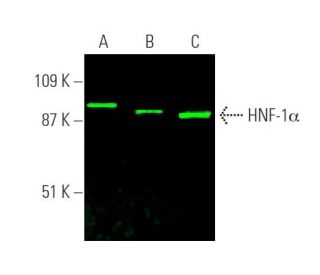 HNF-1α Antibody (F-7) | SCBT - Santa Cruz Biotechnology