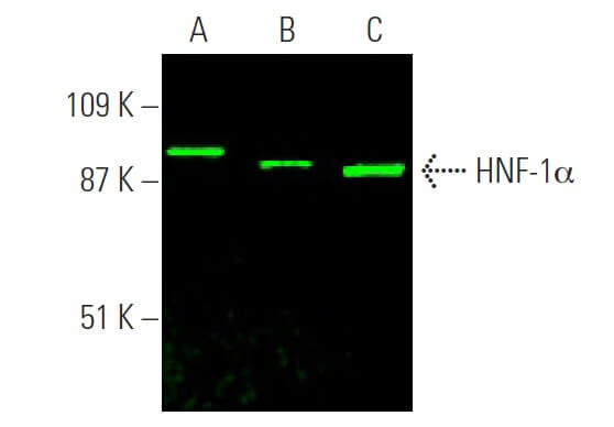 y*a様 ビーコン& ブローブのセット販売 ステンレスピンセット 直180mm （先端ギザ） | ANEXブランドの