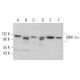 western blotting image from recommended HNF-1α (F-7) monoclonal antibody replacement. Image 380689