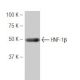 western blotting image from recommended HNF-1β (94.8) monoclonal antibody replacement. Image 53904