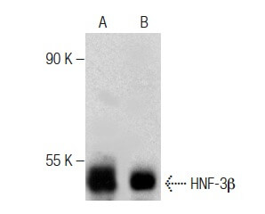 HNF-3β Antibody (H-4) | SCBT - Santa Cruz Biotechnology