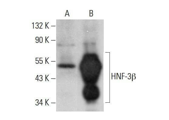 HNF-3β Antibody (H-4) | SCBT - Santa Cruz Biotechnology