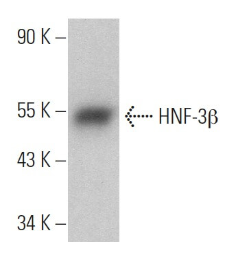 HNF-3β Antibody (H-4) | SCBT - Santa Cruz Biotechnology