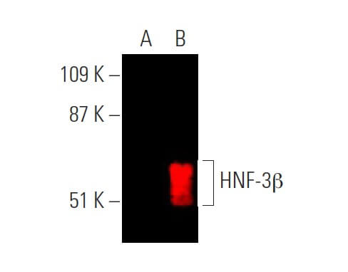 HNF-3β Antibody (H-4) | SCBT - Santa Cruz Biotechnology