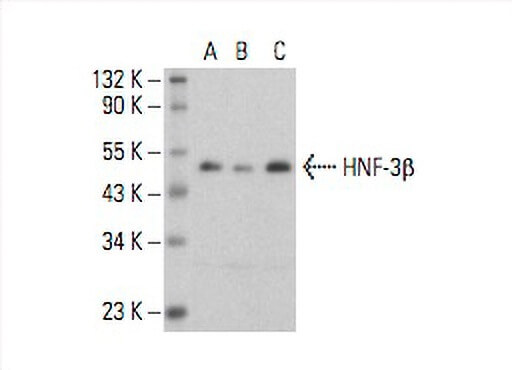 HNF-3β Antibody (H-4) | SCBT - Santa Cruz Biotechnology