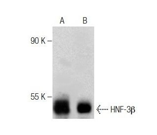 western blotting image from recommended HNF-3&beta; (H-4) monoclonal antibody replacement. Image 283494