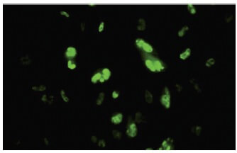 HNF-3β Antibody (RY-7) | SCBT - Santa Cruz Biotechnology