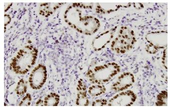 HNF-3β Antibody (RY-7) | SCBT - Santa Cruz Biotechnology