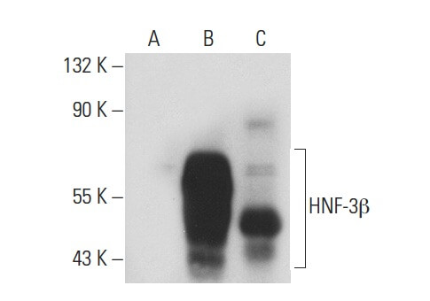 HNF-3β Antibody (RY-7) | SCBT - Santa Cruz Biotechnology