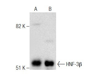 HNF-3β Antibody (RY-7) | SCBT - Santa Cruz Biotechnology