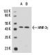western blotting image from recommended HNF-3γ (A-2) monoclonal antibody replacement. Image 15616