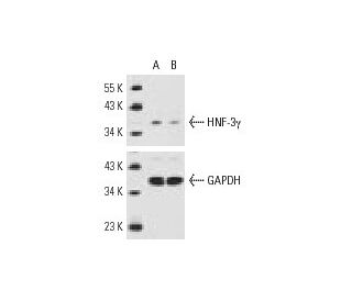 HNF-3&gamma; siRNA (h): sc-35571. Western blot analysis of HNF-3&gamma; expression in non-transfected control (A) and HNF- 