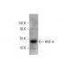 HNF-6 Antibody (B-1) - Western Blotting - Image 353395 