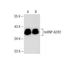 western blotting image from recommended hnRNP A2/B1 (B-7) monoclonal antibody replacement. Image 147904