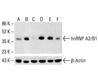 hnRNP A2/B1 Antibody (DP3B3) - Western Blotting - Image 412527