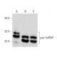 This polyclonal antibody has been discontinued. See our recommended <a href="pan-hnrnp-antibody-c-6">pan hnRNP (C-6)</a> monoclonal antibody (sample data shown). western blotting image from recommended pan hnRNP (C-6) monoclonal antibody replacement. Image 358004