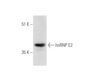 hnRNP E2 Antibody (F-3) - Western Blotting - Image 333658Each CRISPR/Cas9 Knockout (KO) Plasmid product consists of a pool of 3 plasmids designed to ensure identification and cleavage of a specific gene for maximum knockout efficiency. Each plasmid encodes a unique 20 nt sequence derived from the GeCKO (v2) library.