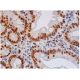 immunohistochemistry image from recommended hnRNP F/H (1G11) monoclonal antibody replacement. Image 284776