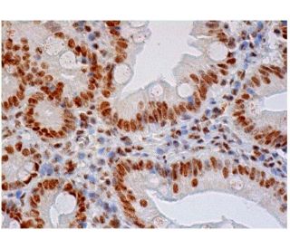 immunohistochemistry image from recommended hnRNP F/H (1G11) monoclonal antibody replacement. Image 284776