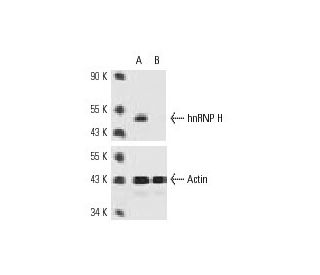 hnRNP H siRNA (h): sc-35579. Western blot analysis of hnRNP H expression in non-transfected control (A) and hnRNP H siRNA