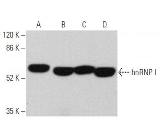 western blotting image from recommended hnRNP I (SH54) monoclonal antibody replacement. Image 359640