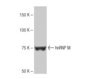 hnRNP M Antibody (5-RE36) - Western Blotting - Image 64967 