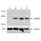 Anticuerpo HNRPLL (H-4): sc-390611. Análisis por Western blot de la expresión de HNRPLL en lisados celulares completos no tratados de HCT-116 (A), tratados químicamente de HCT-116 (B, C) y de K-562 (D). Reactivo de detección utilizado: m-IgG2b BP-HRP: sc-542741. β-Actina (C4): sc-47778 utilizado como control de carga. Reactivo de detección utilizado: m-IgG Fc BP-HRP: sc-525409.  HNRPLL Antibody (H-4) - Western Blotting - Image 415108