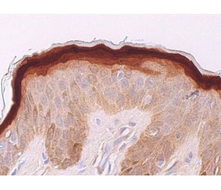 Hop Antibody (E-1) - Immunohistochemistry - Image 369193 