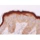 immunohistochemistry image from recommended Hop (E-1) monoclonal antibody replacement. Image 369193