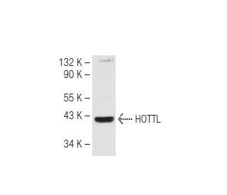 HOTTL Antibody (F-8) - Western Blotting - Image 82276