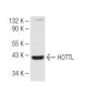 HOTTL Antibody (F-8) - Western Blotting - Image 82276