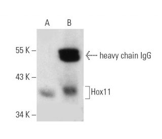 Hox11 Antibody (1D7) - Western Blotting - Image 7163The Double Nickase Plasmid features a U6 promoter for sgRNA expression, a 20 nt targeting sequence, and a gRNA scaffold to guide Cas9n. It includes a CBh promoter for Cas9n (D10A) and puromycin resistance, GFP for transfection verification, and nuclear localization signals (NLS). The 2A peptide allows co-expression of Cas9n and Puro from a single promoter, enabling precise genome editing with reduced off-target effects. 