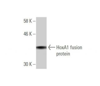 western blotting image from recommended HoxA1 (1E10) monoclonal antibody replacement. Image 348515