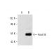 HoxA10 Antibody (C-2) - Western Blotting - Image 144954