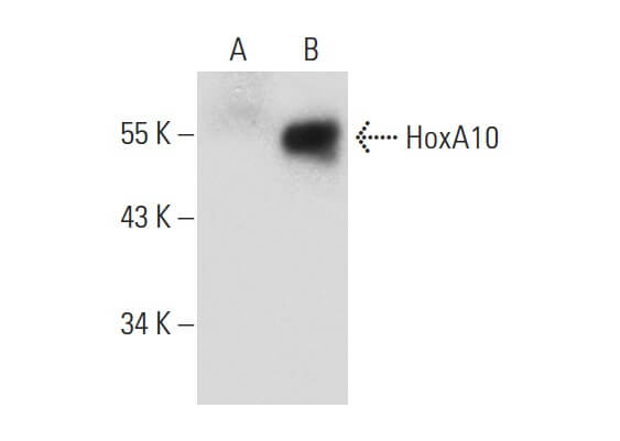 HoxA10 Antibody (E-11) | SCBT - Santa Cruz Biotechnology