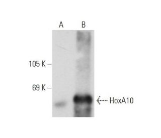 HoxA10 Antibody (E-12) - Western Blotting - Image 129796