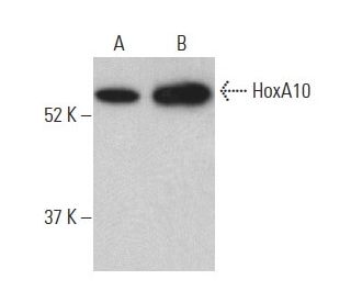 western blotting image from recommended HoxA10 (E-11) monoclonal antibody replacement. Image 398887