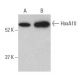 western blotting image from recommended HoxA10 (E-11) monoclonal antibody replacement. Image 398887