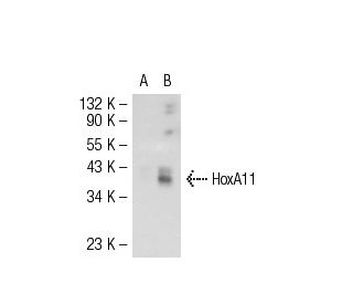 HoxA11 Antibody (739C1a) - Western Blotting - Image 54286 