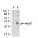 HoxA11 Antibody (739C1a) - Western Blotting - Image 54286 